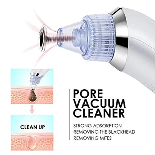 4 in 1 Derma Vacuum Suction Blackhead/Acne/Oil/Pore Cleaner 🌞💁♀️